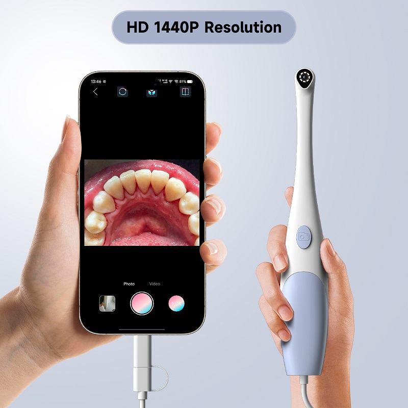 Telecamera Endoscopica Orale 1 - Lighting Visual recensione e prezzo