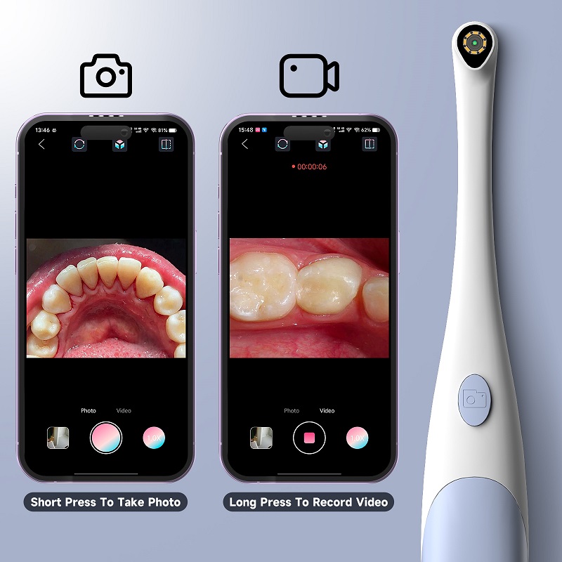 Telecamera Endoscopica Orale 1 - Lighting Visual recensione e prezzo