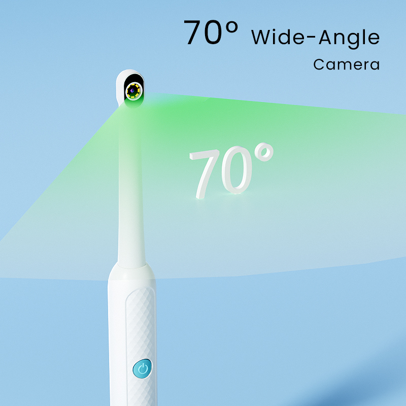 Endoscopio Orale WiFi Wireless - Lighting Visual recensione e prezzo