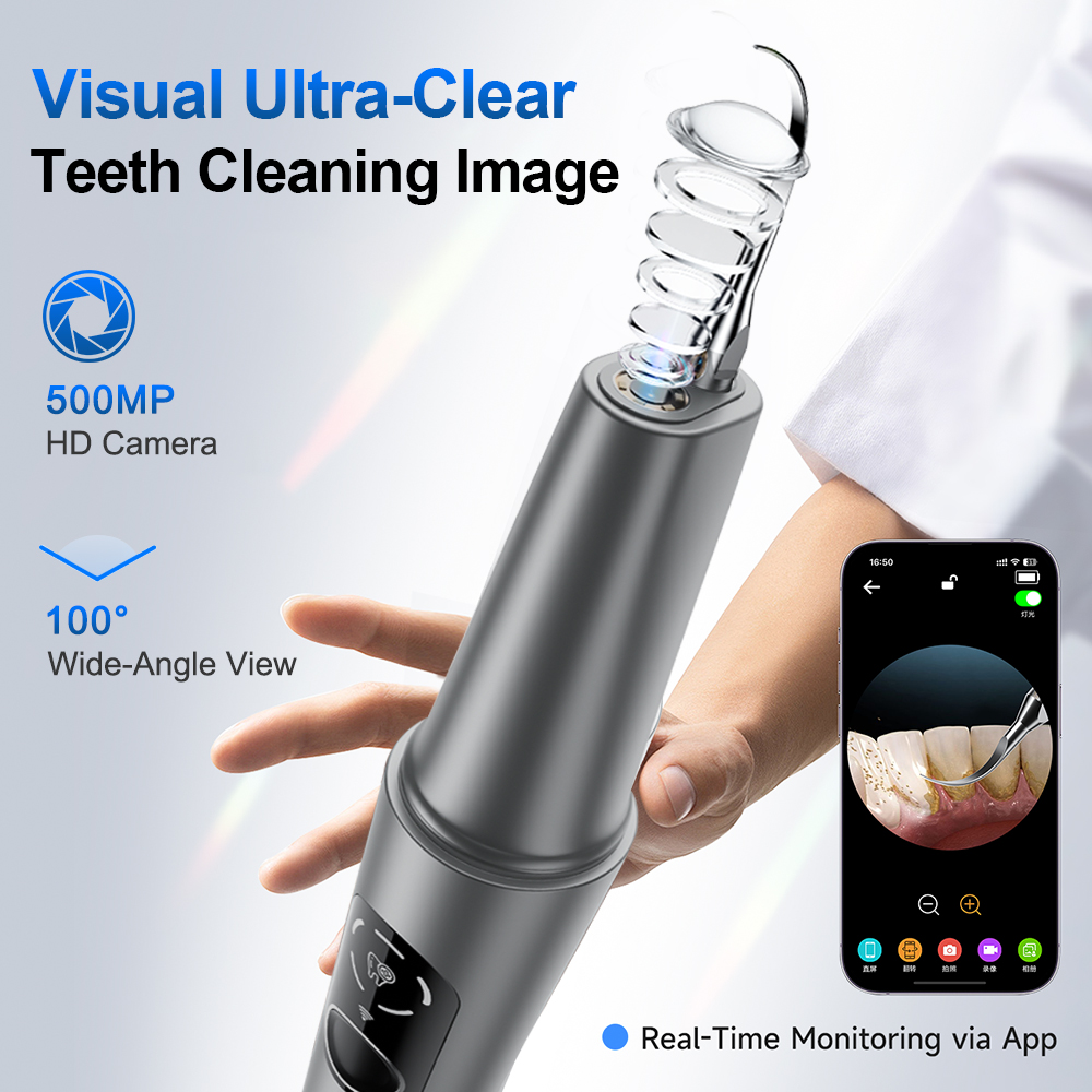 Ablatore Dentale a Ultrasuoni  - Lighting Visual recensione e prezzo